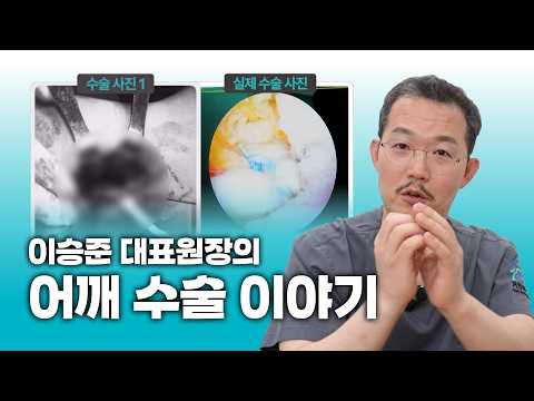 거인체크｜이승준 대표원장의 수술 리뷰